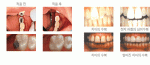 CharmFil plus® A1-Dentkist- Korea - Image 2